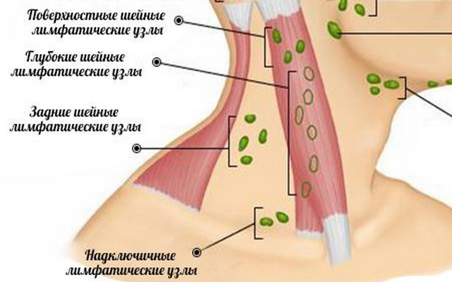 Воспаление лимфоузлов на шее при раке пищевода thumbnail